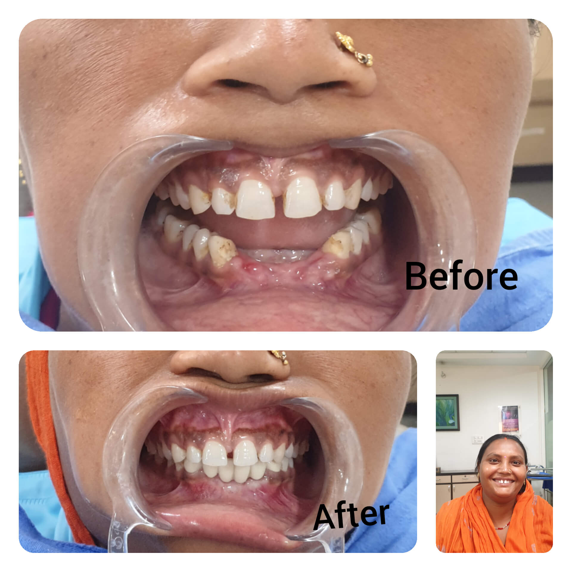 Dental Care In Pregnancy Jindal Dental Care And Implant Centre